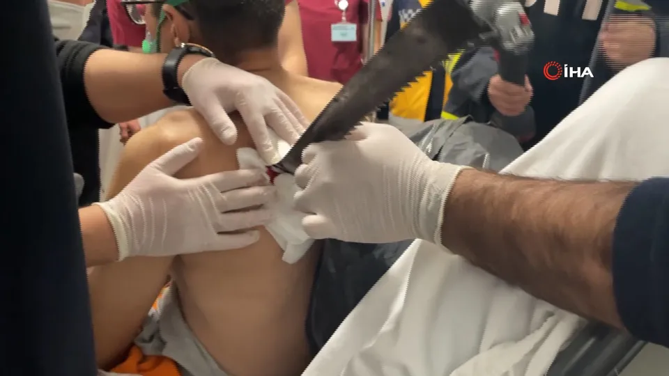 Korkunç olay! 40 santimlik testere sırtına saplandı