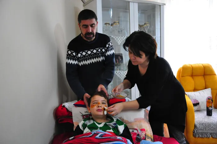 Bir köpek saldırısı haberi daha! 8 yaşındaki Mert'in yüzüne 60 dikiş atıldı - 1