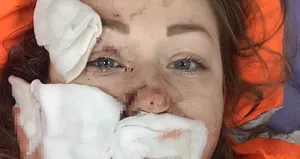 Boşanmak isteyen eşine falçatayla saldırmıştı!