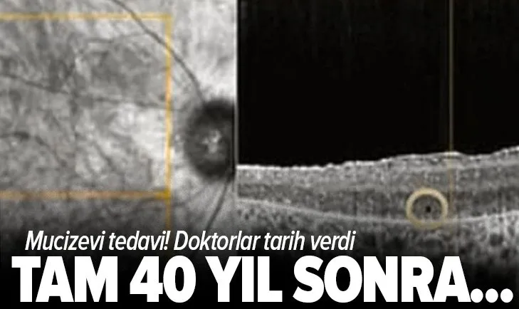 Doktorlardan mucizevi tedavi! 40 yıl sonra ilk defa görüldü
