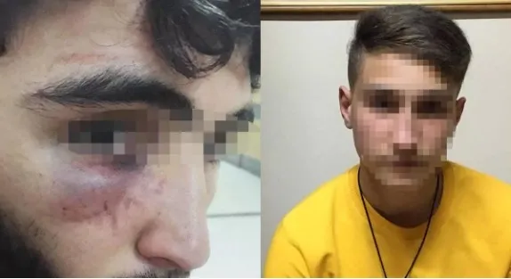 İş yerinde dehşet! 15 yaşındaki çırağa işkence, ağabeyine dayak - 2