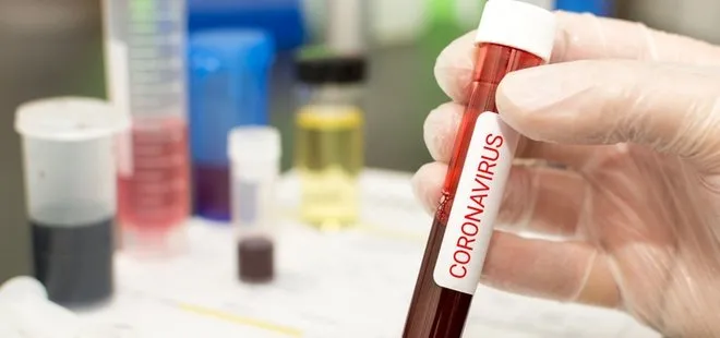 Son dakika: Koronavirüs ile ilgili flaş haber! Covid-19’a karşı yüksek etkili antikor bulundu...