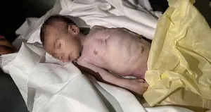 İsrail 5 Filistinliyi daha açlıkla katletti