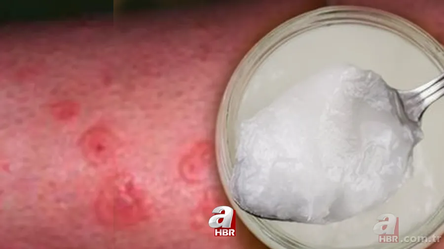 Egzamayı 24 saat içinde yok oluyor! Yarım litre suya bir tutam eklemeniz yetecek! 1