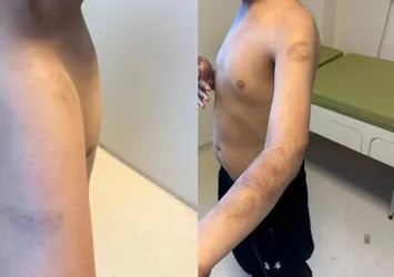 İstanbul'da özel okulda otizmli çocuğa şiddet iddiası! Skandal savunma