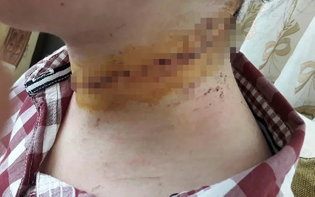 Kayseri’de cani koca eşinin boğazını kesmeye çalıştı! Kızının çığlıkları yürek yaktı - 1