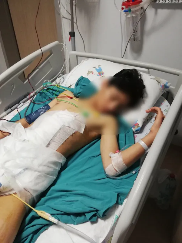 Son dakika: Çorum'da dehşet: Metehan köpeklerden kaçarken düştü! Dalağı parçalandı - 6