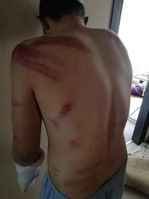 1615285505740.jpg İki yüz lira alacağı olan 16 yaşındaki gence 5 saat işkence - 5
