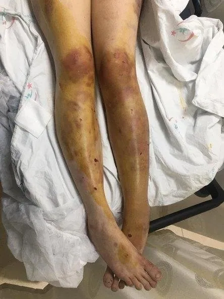 1602040614475.jpeg Şanlıurfa'da kan donduran olay! Odaya kapatıp 5 gün boyunca işkence yaptı... - 1