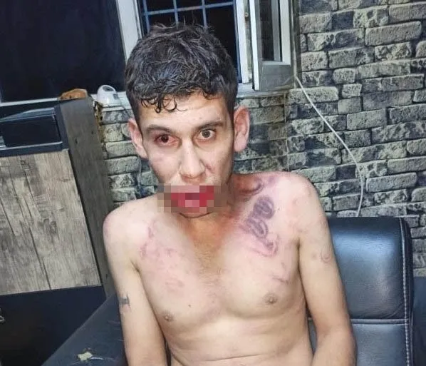 1721134257986.jpg Kerpetenle dişlerini söküp hamamböceği yedirdiler! Antalya'da kan donduran işkence: 4 yıldır kabuslarla uyanıyor - 2