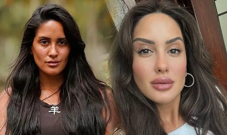 Survivor’un eski yarışmacısı Sahra Işık değişimiyle pes dedirtti! Estetik öncesi ve sonrası...