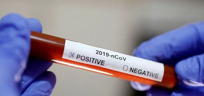 Son dakika: Dünya genelinde yeni tip koronavirüs vaka sayısı 14 milyonu aştı