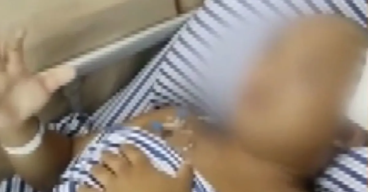 Elleri ve ayaklarında uyuşukluk çoğalınca doktora gitti! 17 yıldır beyninde o hayvanla yaşamış