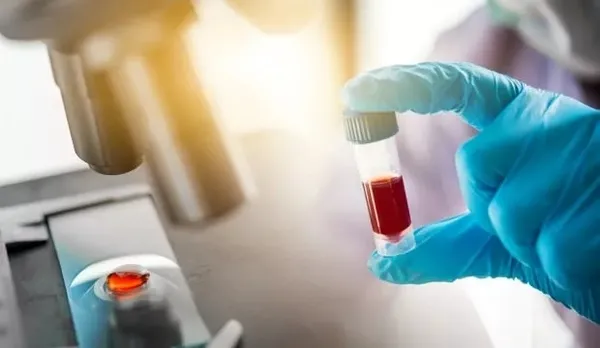 turkiyede-koronavirus-salgini-nasil-duracak-tip-fakultesi-dekani-gerekli-islemi-acikladi-1608133107005.jpeg Türkiye'de koronavirüs salgını nasıl duracak? Tıp Fakültesi Dekanı gereken işlemi açıkladı - 6