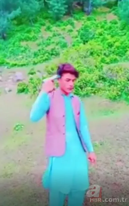 TikTok'taki meydan okuma hastanede bitti! Kendisini yaktı 15