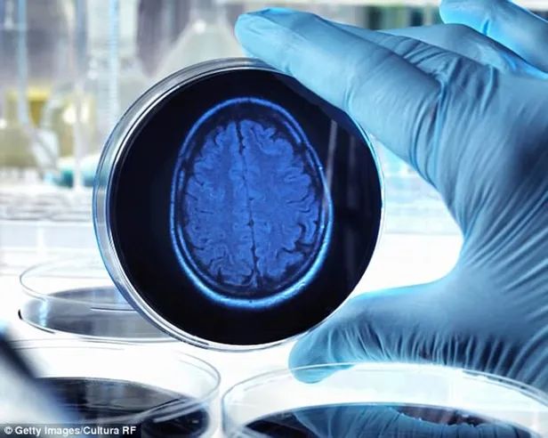 Uzman isim unutkanlığa karşı 3 altın baharatı açıkladı! Fil hafızası için 1 çay kaşığı yeterli