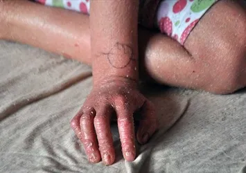 Sağlık Bakanı Koca'dan müjde: Yerli üretim için harekete geçtik
