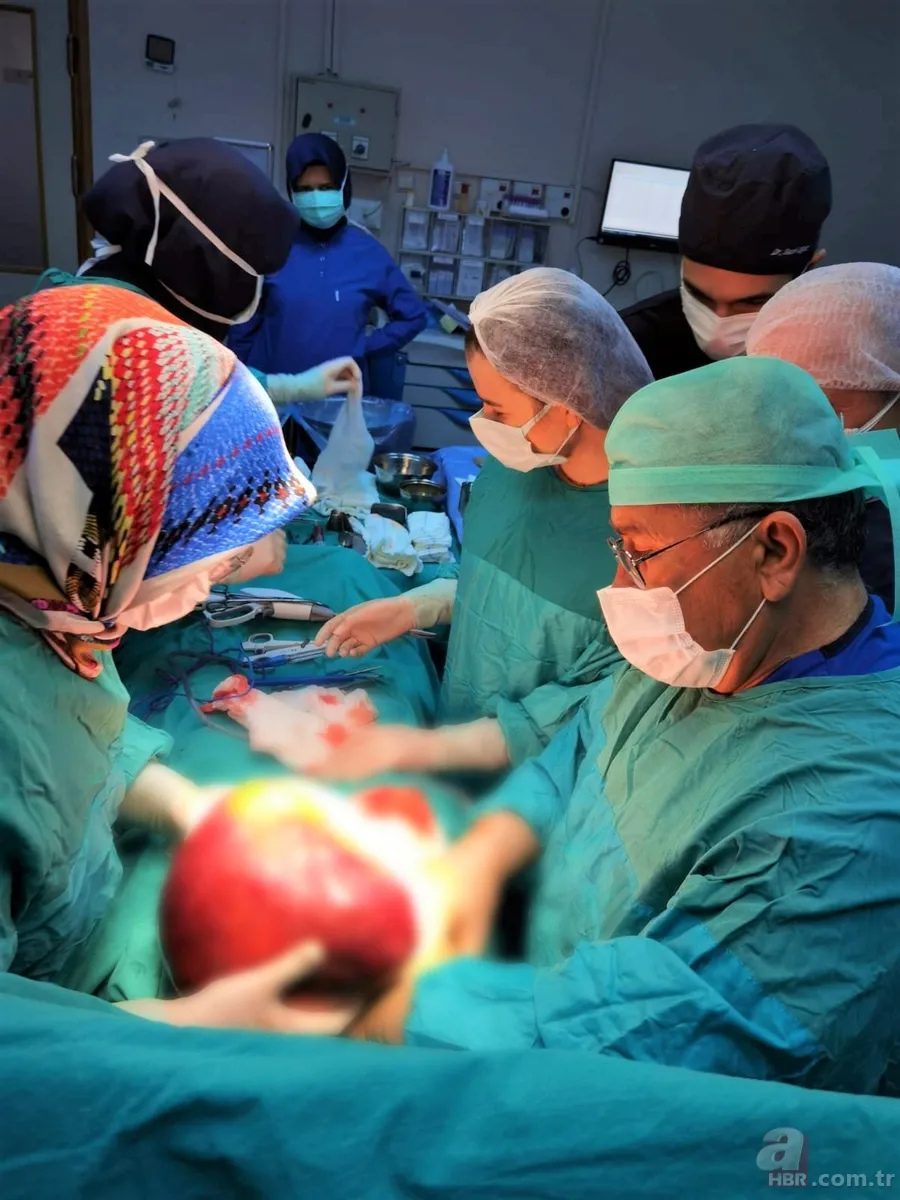 Amasya’da 22 yaşındaki genç kız karın ağrısı şikayetiyle hastaneye gitti! Gerçek şoke etti: Tam 5 kilo 2