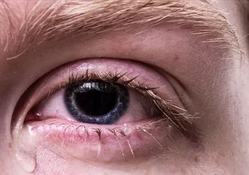 Kışla birlikte gelen göz enfeksiyonlarına dikkat