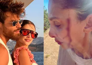 Can Yaman'ın şiddet gören sevgilisi kanlar içinde paylaştı! "Gerçekleri konuşma zamanı"