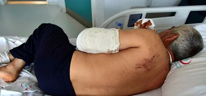 Muğla'da pitbull dehşeti! Kolunu parçaladılar