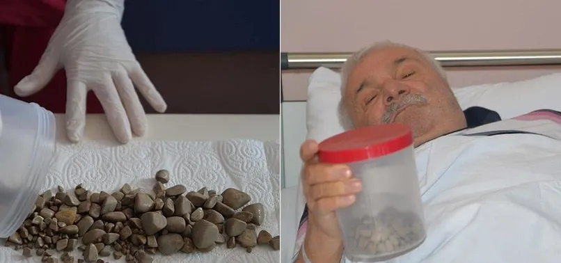Mesanesinden binden fazla taş çıktı