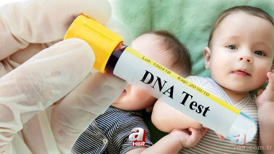 İkizlerin farklı babalardan olması mümkün mü, daha önce yaşandı mı? Heteropaternal süperfekondasyon nedir, ne anlama gelir? 1