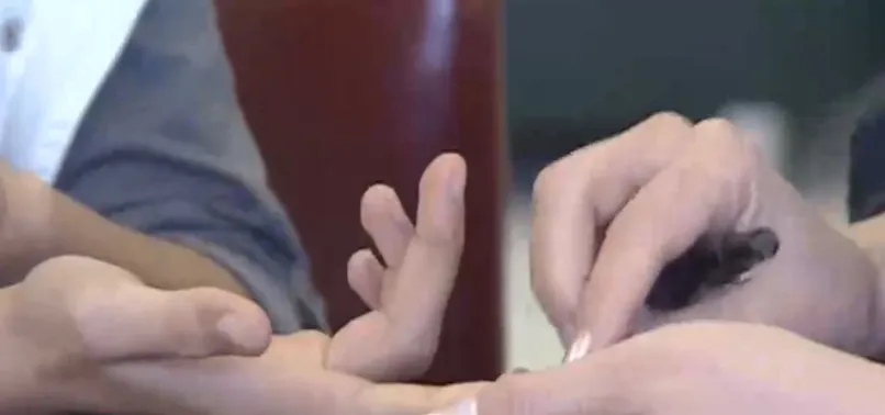 Çağımızın hastalığı: Diyabet! 10 yılda yüzde yüz arttı