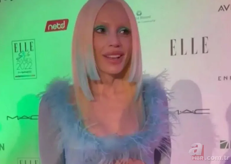 Gülşen estetiği abarttı! Son hali hayal kırıklığı yarattı: "Aysel Gürel olmuşsun" 6