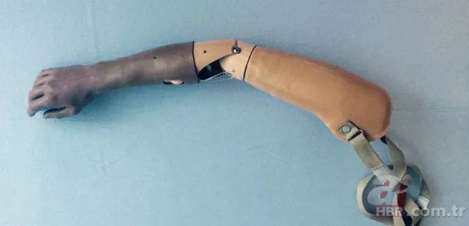 Oyuncu olmak uğruna kolunu kesti "Savaş gazisiyim" dedi 8