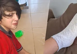Oyuncak bir anda patladı! 11 yaşındaki Furkan’ın ayağında 2’nci derece yanık oluştu