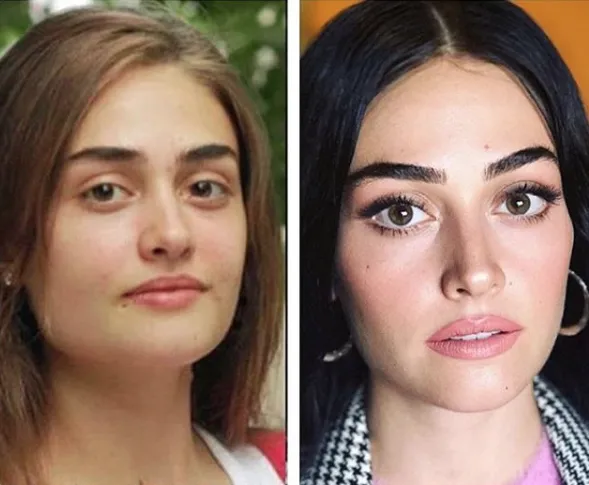 Hizmetciler In Atiye Si Algi Eke Nin Estetiksiz Hali Gorenleri Soke Etti