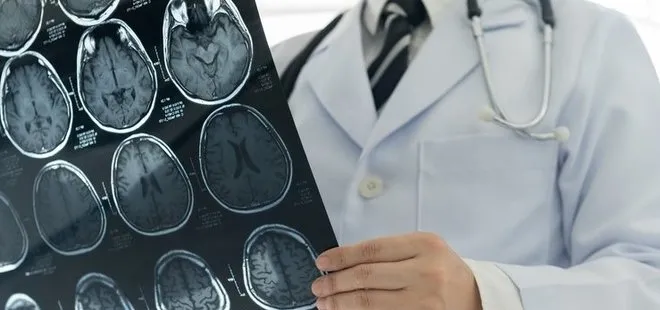 Beyin kanaması ve tümörü olanlara yapay zekayla 5 saniyede ön tanı konulabilecek