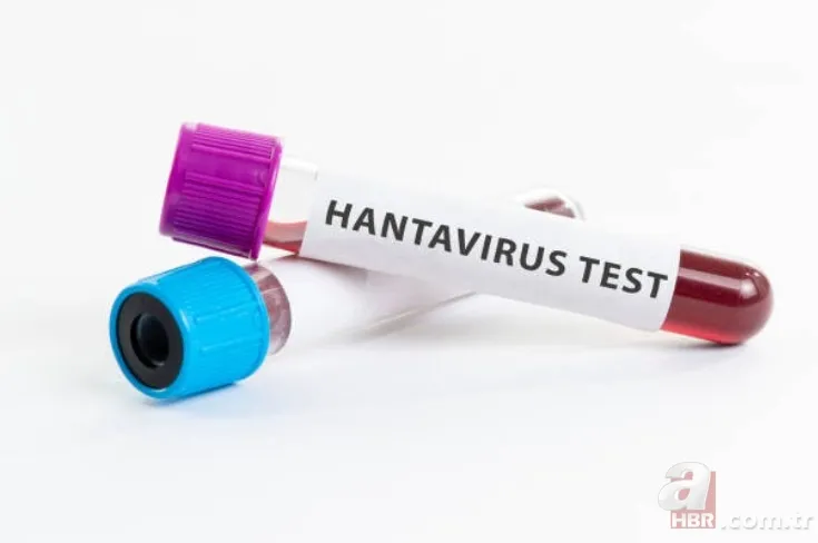 Yeni virüs mü çıktı? Hanta virüsü bulaşıcı mı? Hanta virüsü belirtileri nelerdir? Hantavirüs salgını var mı? 3