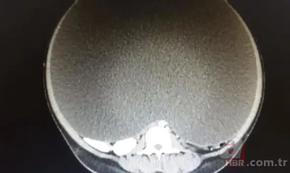 Doktorlar bile hamile sandı! Çıkanlara kimse inanamadı... 7