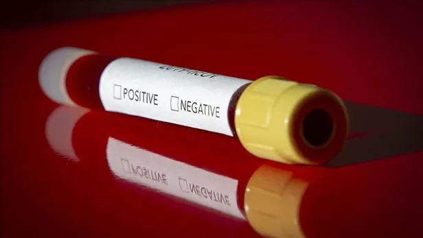 e-Nabız korona test sonucu sorgulama! e-Nabız Covid-19 test sonucu nasıl öğrenilir? - 3