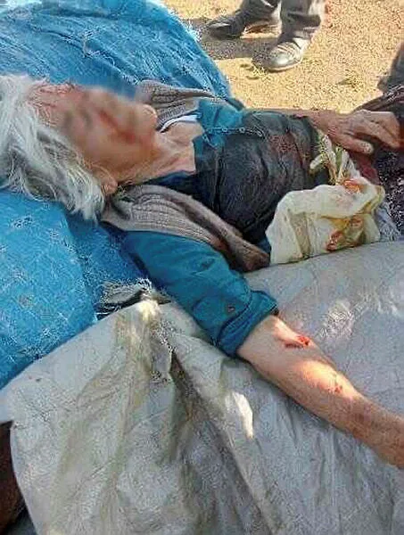 Niğde'de sokak köpeği dehşeti! Yaşlı kadın az kalsın parçalanıyordu - 2