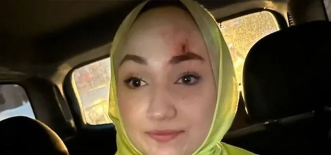 İzmir’de Erdoğan’ın seçim zaferini kutlayan genç kıza taşlı saldırı! Alnı kanayan genç kız hastaneye götürüldü...