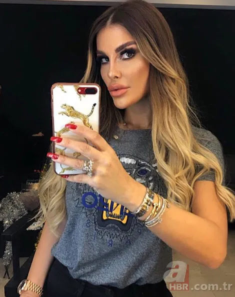 Adanalı dizisinin güzel oyuncusu Tuğçe Özbudak yeni haliyle olay oldu! Estetik yaptırmaktan öyle bir hale geldi ki... 5