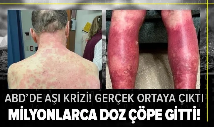 Son dakika | ABD’de aşı krizi! Milyonlarca doz Johnson&Johnson aşısı çöpe gitti