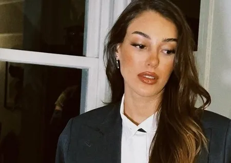 Oyuncu Dilan Çiçek Deniz'e köpek saldırdı! Sağlık durumu...