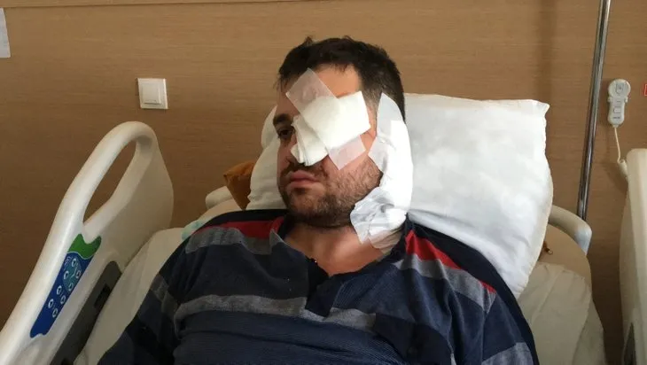 Konya'da korkunç olay! Avukatı gözünden bıçakladı