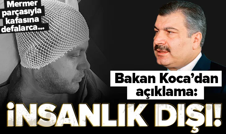 Bakan Koca! İnsanlık dışı