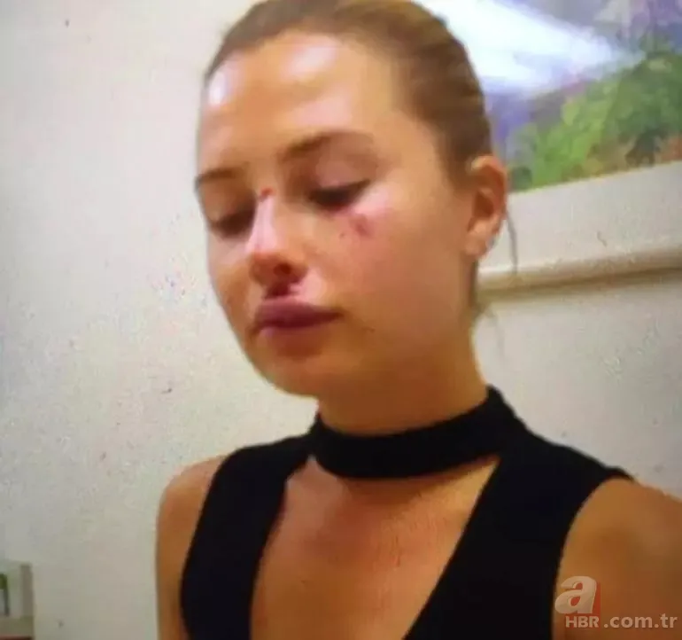 Chloe Loughnan Serdar Ortaç sessizliğini bozdu! Biten evliliğiyle ilgili ilk kez konuştu: Kumarı benden çok sevdi 15