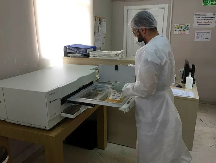 İmmün plazma tedavisinde yeni yöntem! Cihaz ile virüs ve patojenler arındırılıyor - 2