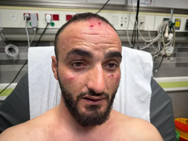 Katliamın gölgesinde 10. Cuma Namazı! Gazetecilere alçak saldırı! A Haber’de dehşet anlarını anlattı: Yere yatırıp dövdüler