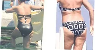 Gülben Ergen’e selülit tepkisi