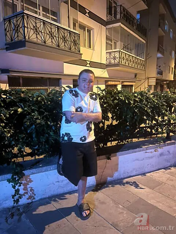 Kuaförde korkunç olay! 14 yaşındaki çocuğun tüm vücudu yandı 9