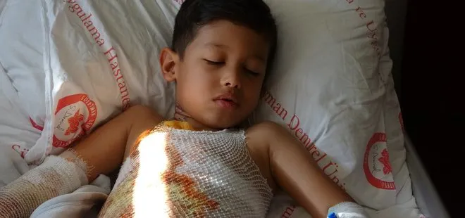 6 yaşındaki Mehmet Ali’yi turşu etkinliği yaktı! Günlerce hastanede kalacak