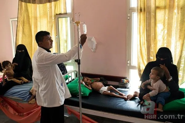 Yemen’de hayata tutunmaya çalışan Emel Hüseyin yaşamını yitirdi